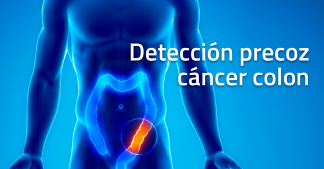 La Aecc se moviliza para concienciar sobre el cáncer de colon