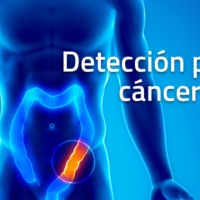 La AECC se moviliza para concienciar sobre el cáncer de colon